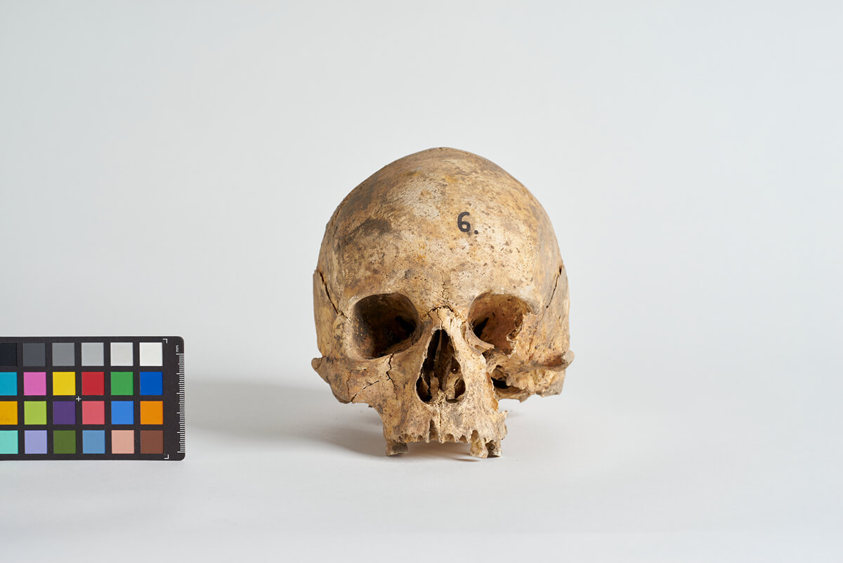 Czaszka mężczyzny, który zmarł w wieku 30-40 lat, ossuarium 2046. Fot. J. Szmit.