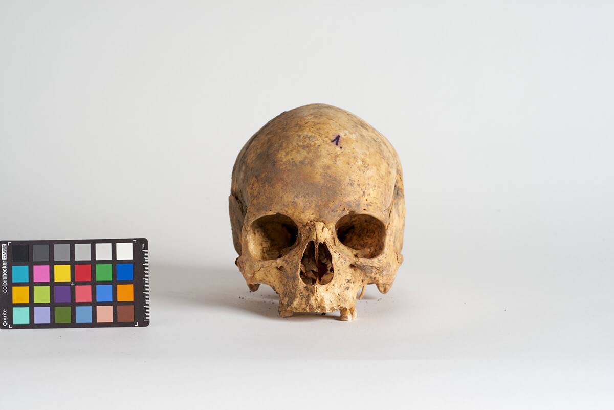 Czaszka kobiety, która zmarła w wieku 20-30 lat, ossuarium 2046. Fot. J. Szmit.