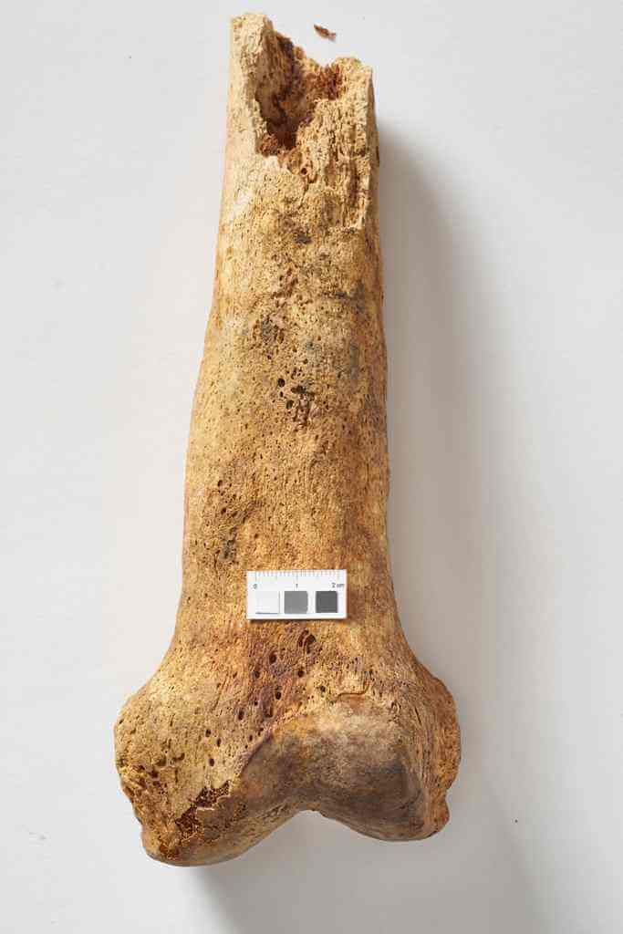 Poważne zmiany zapalne na kości udowej, charakterystyczne dla syfilisu, osoba dorosła, ossuarium 2006. Fot. J. Szmit.