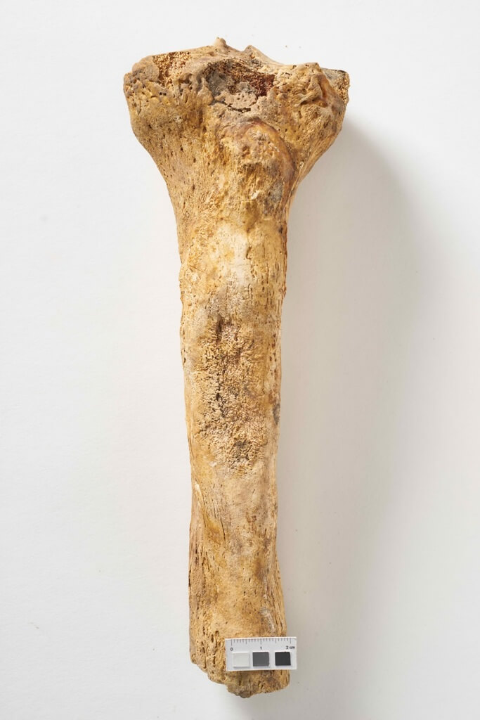 Zaawansowane zmiany zapalne na kości piszczelowej, charakterystyczne dla syfilisu, nieaktywne w chwili zgonu, osoba dorosła, ossuarium 3009. Fot. J. Szmit.