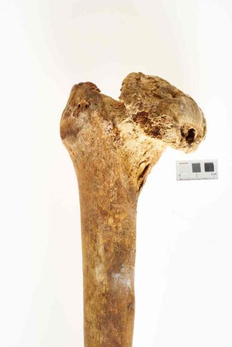 Zniekształcenie i zeszlifowanie powierzchni stawowej głowy kości udowej, ślady prawdopodobnie po skostnieniu tkanek miękkich w obrębie krętarza większego, osoba dorosła, ossuarium 2006/188/132.
